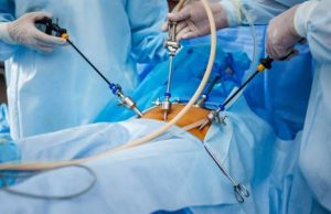 laparoscopic-surgeries